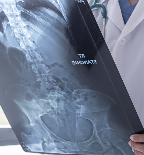 A doctor in Atlanta, GA, examining a patient's X-ray for diagnosis