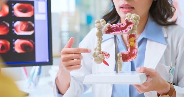 How Genetics Impact Your Risk of Colorectal Cancer featured image